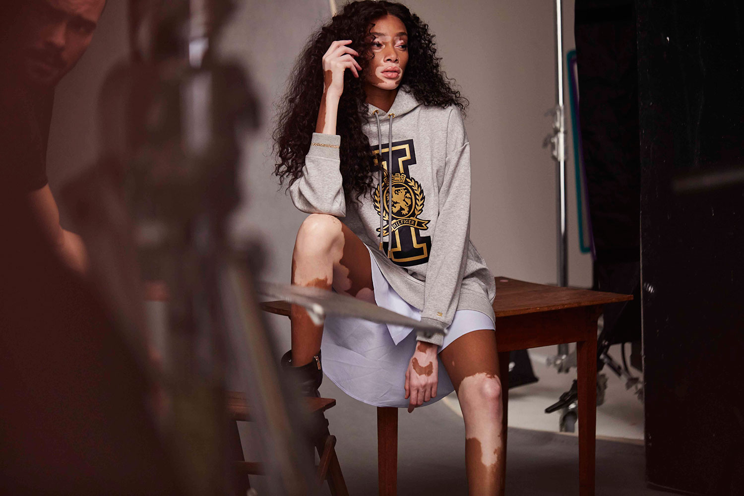 Winnie Harlow - Foto: Divulgação