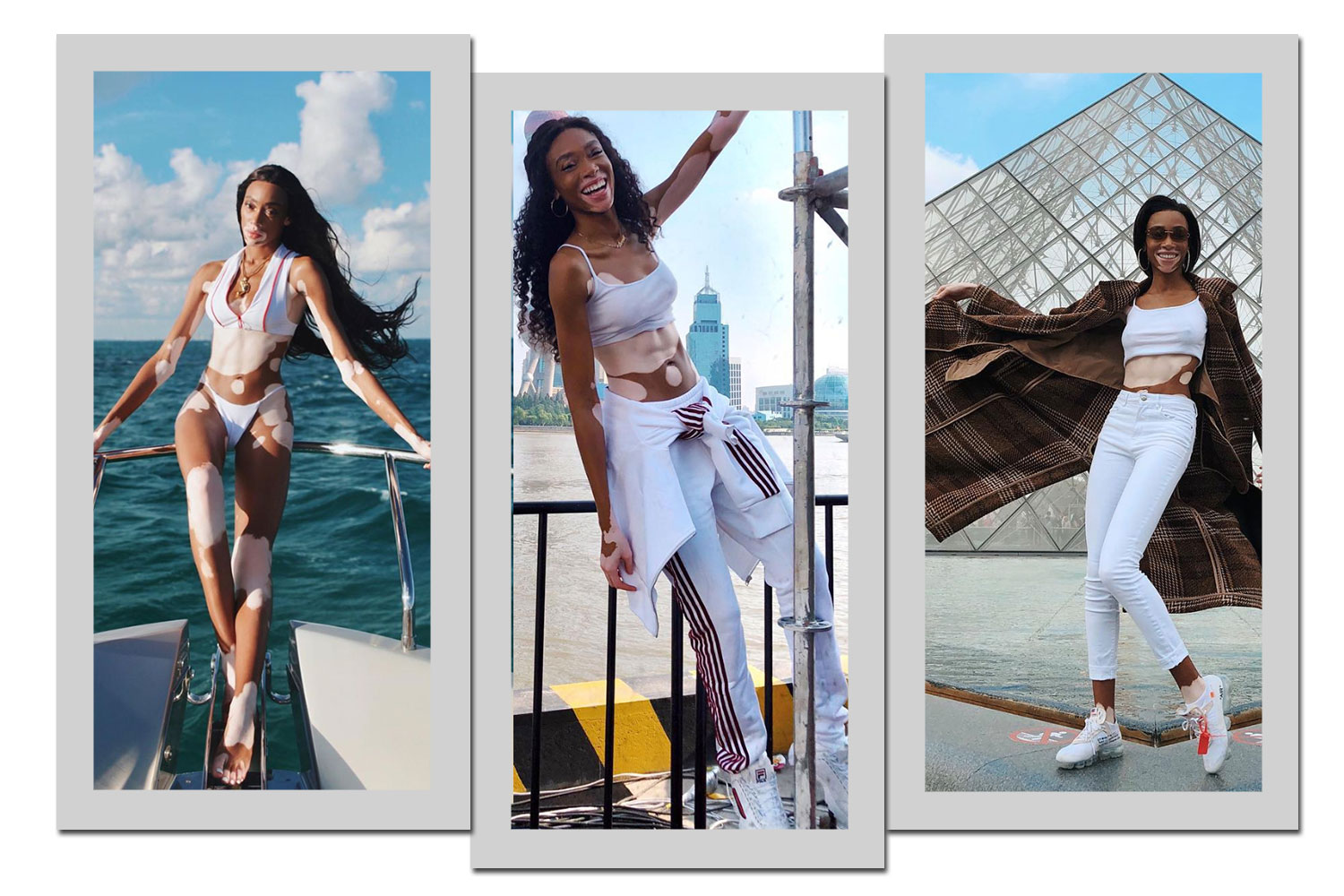 Foto: Reprodução/Instagram/@winnieharlow