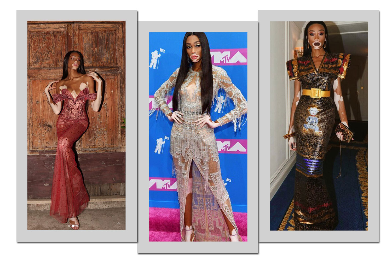 Foto: Reprodução/Instagram/@winnieharlow