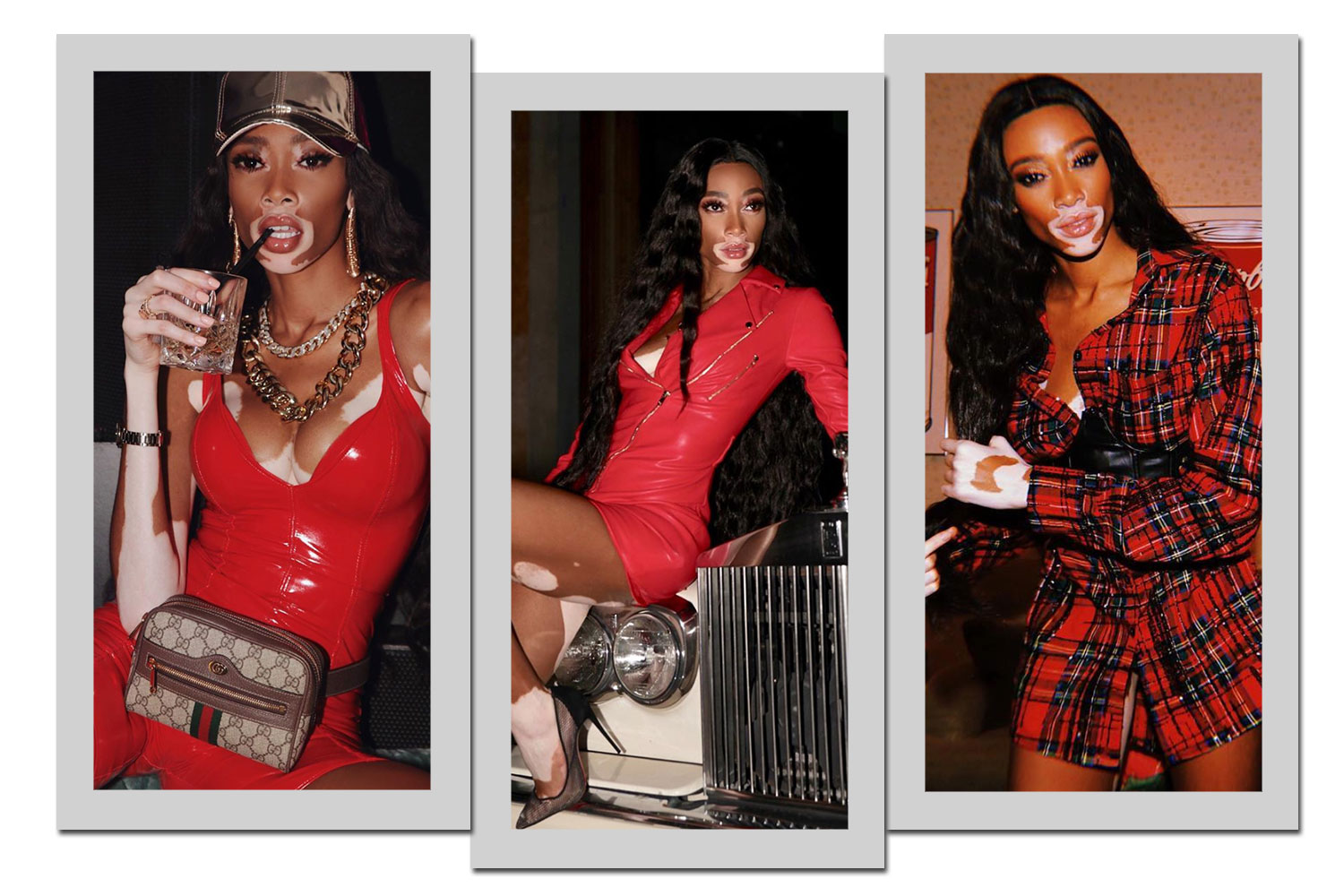 Foto: Reprodução/Instagram/@winnieharlow